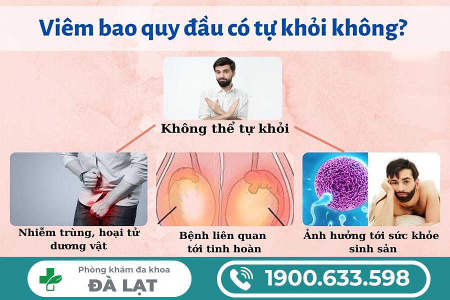 Hình ảnh minh họa